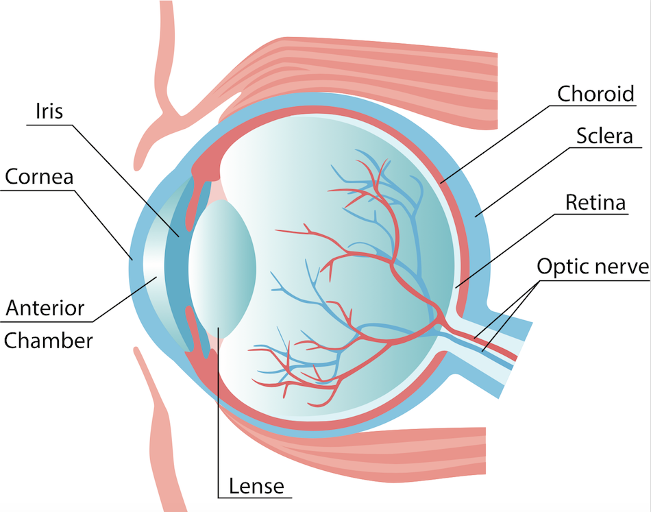 Corneal transplant