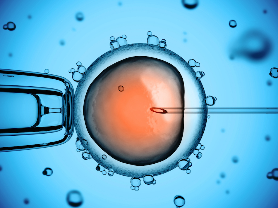 Intrauterine insemination