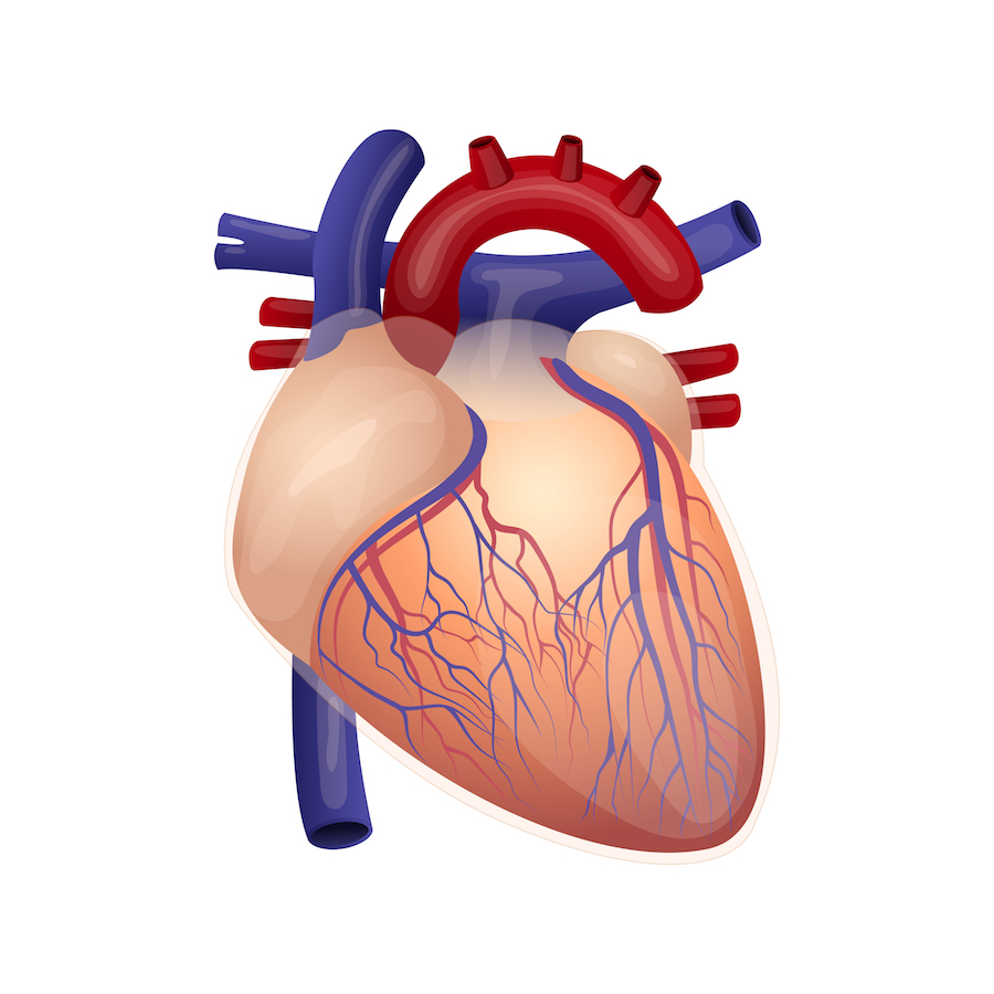 Coronary bypass surgery (CABG)